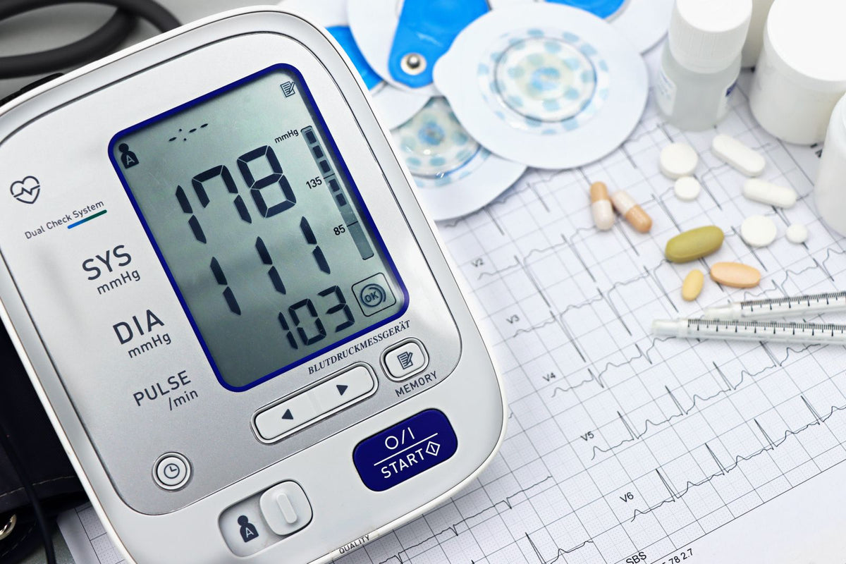 Digital blood pressure monitor beside an ECG printout and medical tools on a desk